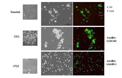 유방암 순환 종양세포 세포주에서 Anoikis 차이 조사