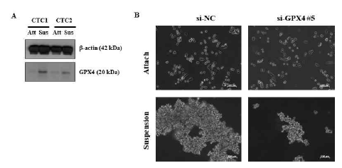 순환 종양세포 세포주에서 GPX4의 발현의 변화와(A) GPX4 knock down 에 의한 CTC1 세포 Aggregate 형성 변화 조사(B)