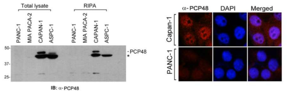 Pancreatic cancer 세포주에서 PCP48 발현 분석
