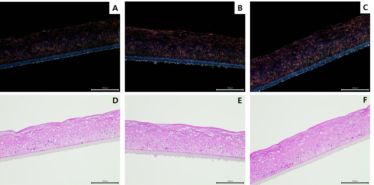 나노물질을 처리한 피부조직의 암시야현미경 비교 이미지 (Darkfield image)A: VEH, B: Fe2O3, C: TiO2 (Brightfield image)D: VEH, E: Fe2O3, F: TiO2