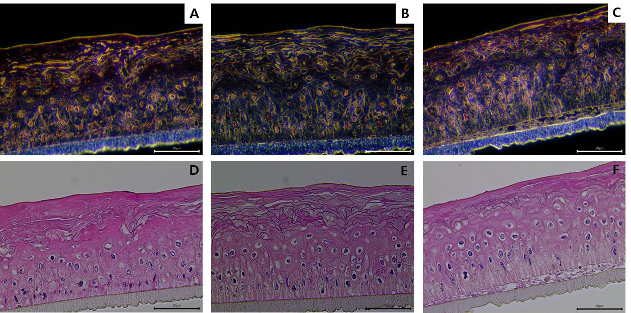 나노물질을 처리한 피부조직의 암시야현미경 비교 이미지 (Darkfield image)A: VEH, B: Fe2O3, C: TiO2 (Brightfield image), D: VEH, E: Fe2O3, F: TiO2