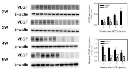 MCT 투여 후 폐에서의 vascular endothelial growth factor (VEGF) 발현 변화