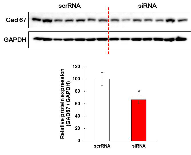 Results of Western blotting in the mice striatum injected scrRNA or GAD67 siRNA stereotaxically. The mice were treated with either a negative control (scrRNA, 300 pmole/μL, striatal injection) or GAD67 siRNA (300 pmole/μL, striatal injection) once, and then climbing behavior test with saline was performed as methods section after 3 days from striatal injection day. Each protein expression was normalized to the relative amplification of GAPDH. Data are expressed as the mean ± S.E. (n=7 for each group, Student’s t-test, *p<0.05 vs. scrRNA group). scrRNA: Scramble RNA