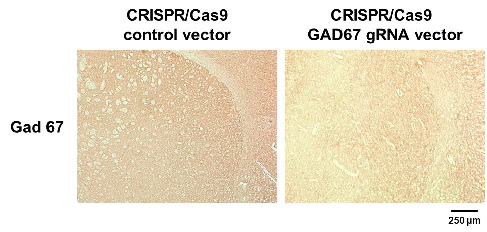 Result of immunohistochemistry in the mouse striatum injected control vector or CRISRPT/Cas9 GAD67 gRNA vector stereotaxically. Immunohistochemistry staining of GAD67 in the right striatum was performed on 10-μm-thick sections of mouse brain with GAD67 primary antibody and secondary antibody. Original magnification x200