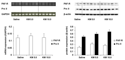 케타민 투여 후 행동민감화와 조건장소선호도를 평가한 야생형 생쥐 (C57BL/6 생쥐)의 선조체에서 PAF-R 및 Prx II의 mRNA와 단백질 발현의 변화. KM 5.0 or 10.0 = 케타민 5.0 or 10.0 mg/kg, i.p. 각 수치는 5-8 마리의 평균 ± 표준오차임. One-way ANOVA