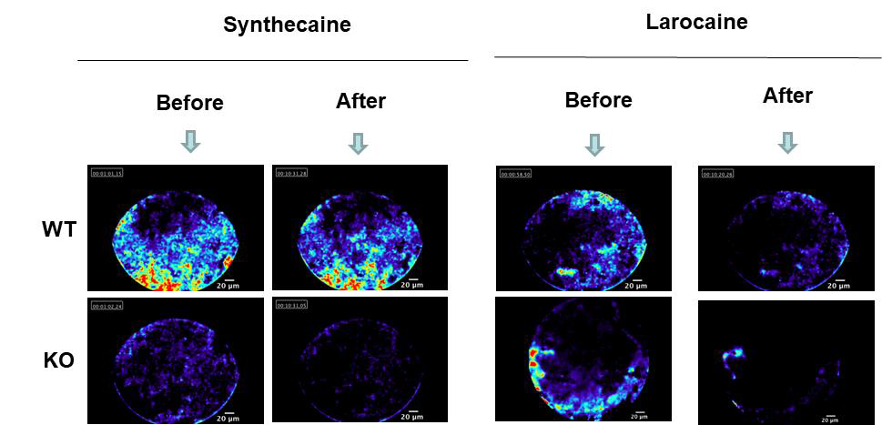 Effect of synthecaine and larocaine on calcium dynamics. Calcium imaging was performed with fiber type confocal microscope and fluo-4AM. Synthecaine (7.5 mg/kg, i.p.) and larocaine (30 mg/kg, i.p) decrease calcium intensity in KO mice than WT mice