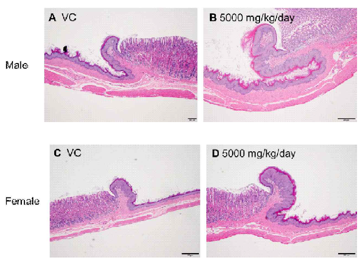 (A) Stomach from a male SD rat of control group (Main study). (B) Hyperplasia of squamous cells in stomach from a male 5000 mg/kg/day treatment group (Main study). (C) Stomach from a female SD rat of control group (Main study). (D) Hyperplasia of squamous cells in stomach from a female 5000 mg/kg/day treatment group (Main study). Scale bar, 200 μm; H&E