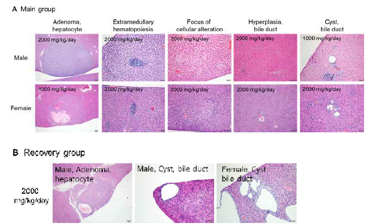 (A) Representative histopathology of liver from SD rat of 1000 or 2000 mg/kg/day treatment group (main group), (B) Representative histopathology of liver from SD rats of 2000 mg/kg/day treatment group (recovery group), Scale bar, 50 or 200 μm; H&E