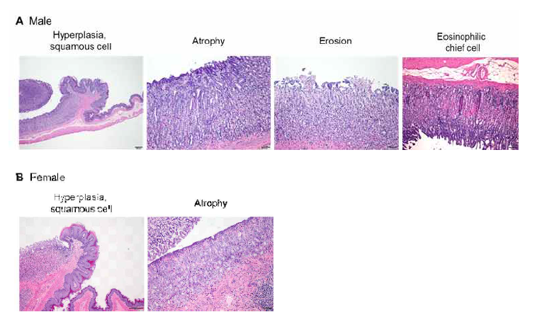 (A) Reprsentative histopathology of stomach from male SD rat of 2000 mg/kg/day treatment group (main group), (B) Representative histopathology of stomach from female SD rat of 2000 mg/kg/day treatment group (main group), Scale bar, 50, 100 or 200 μm; H&E