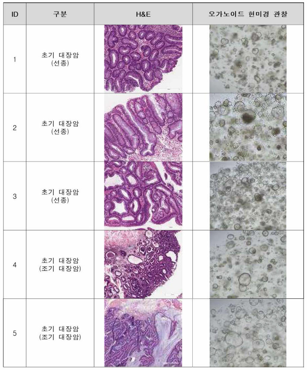확보한 대장암 종양 조직 및 임상 정보
