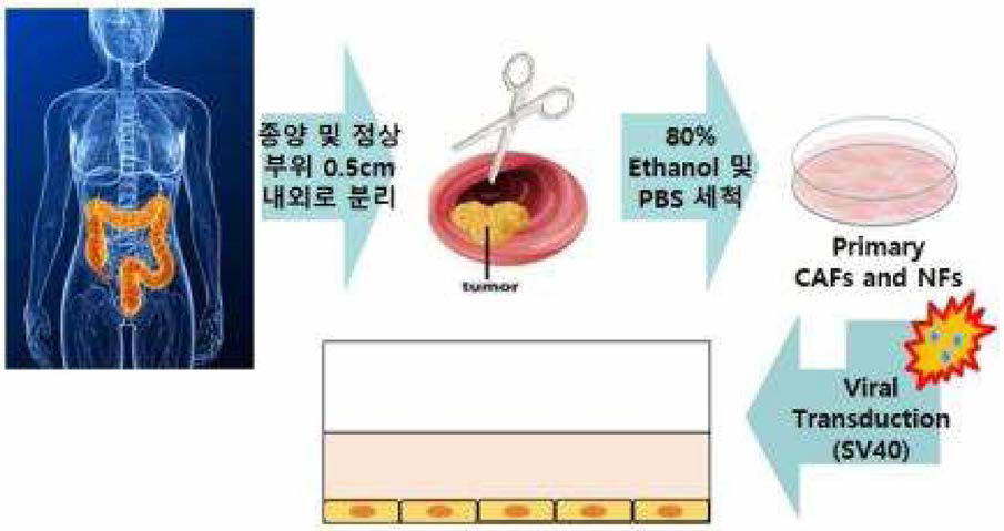 대장암 유래 1차세포 배양과 암 연관 섬유아세포 배양 방법