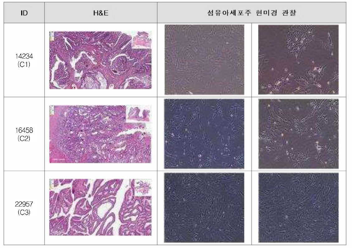 확보한 대장암 종양 조직 및 암 연관 섬유아세포주 (연속)