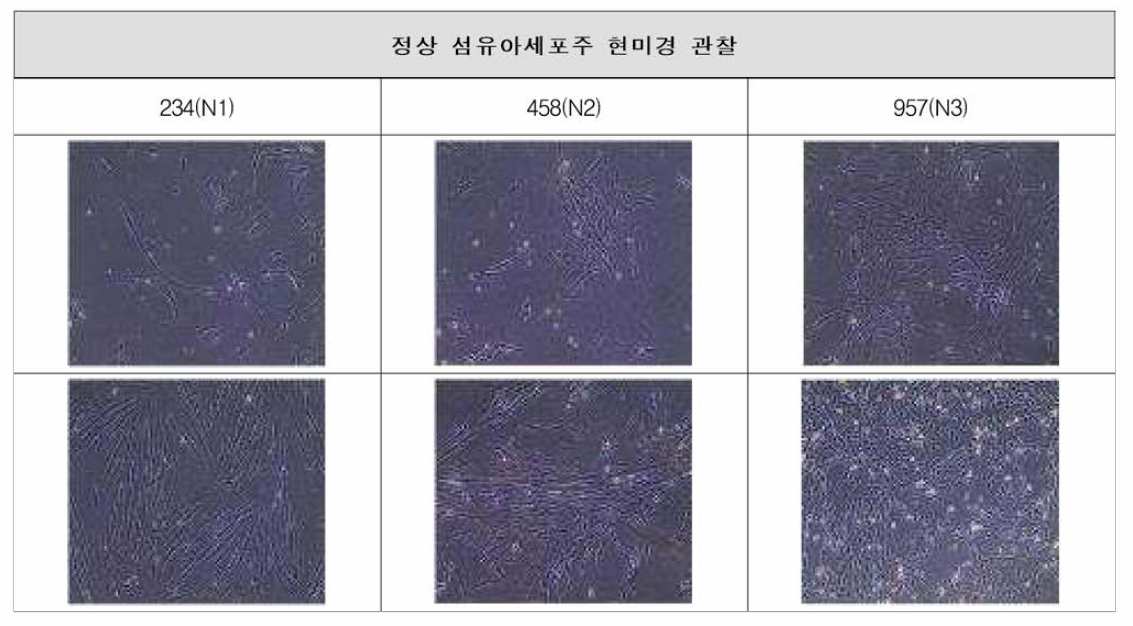 확보한 환자 유래 정상 섬유아세포주