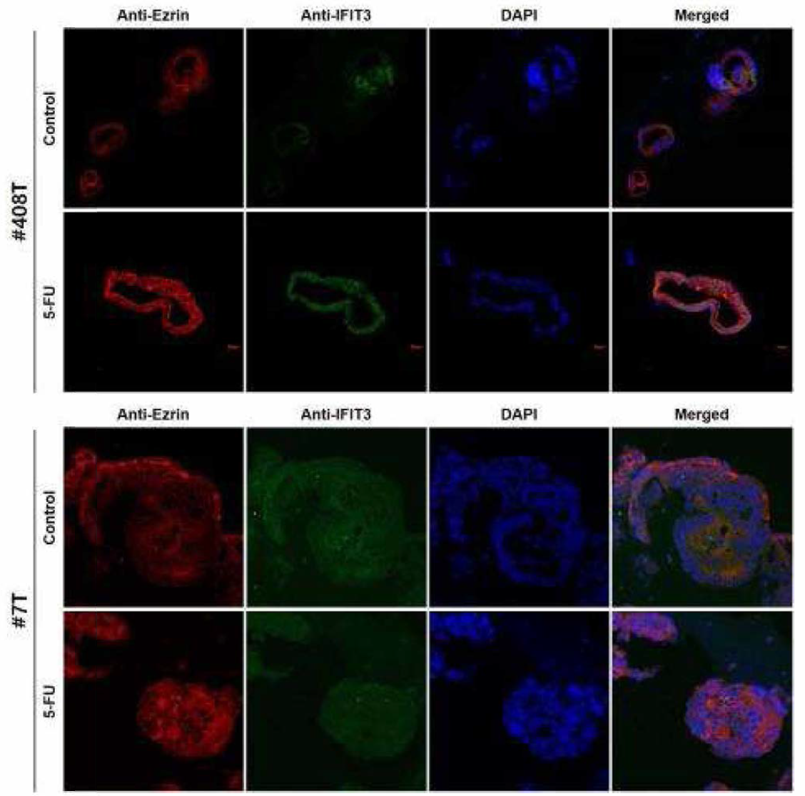 오가노이드 13종의 Anti-Ezrin과 Anti-IFIT3 이중형광염색