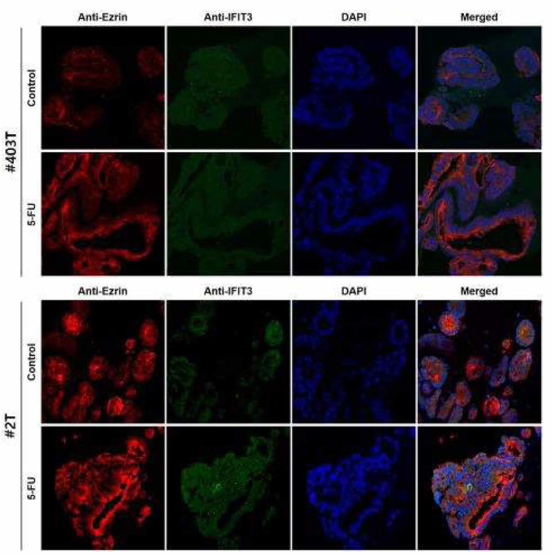 오가노이드 13종의 Anti-Ezrin과 Anti-IF IT3 이중형광염색 (연속)