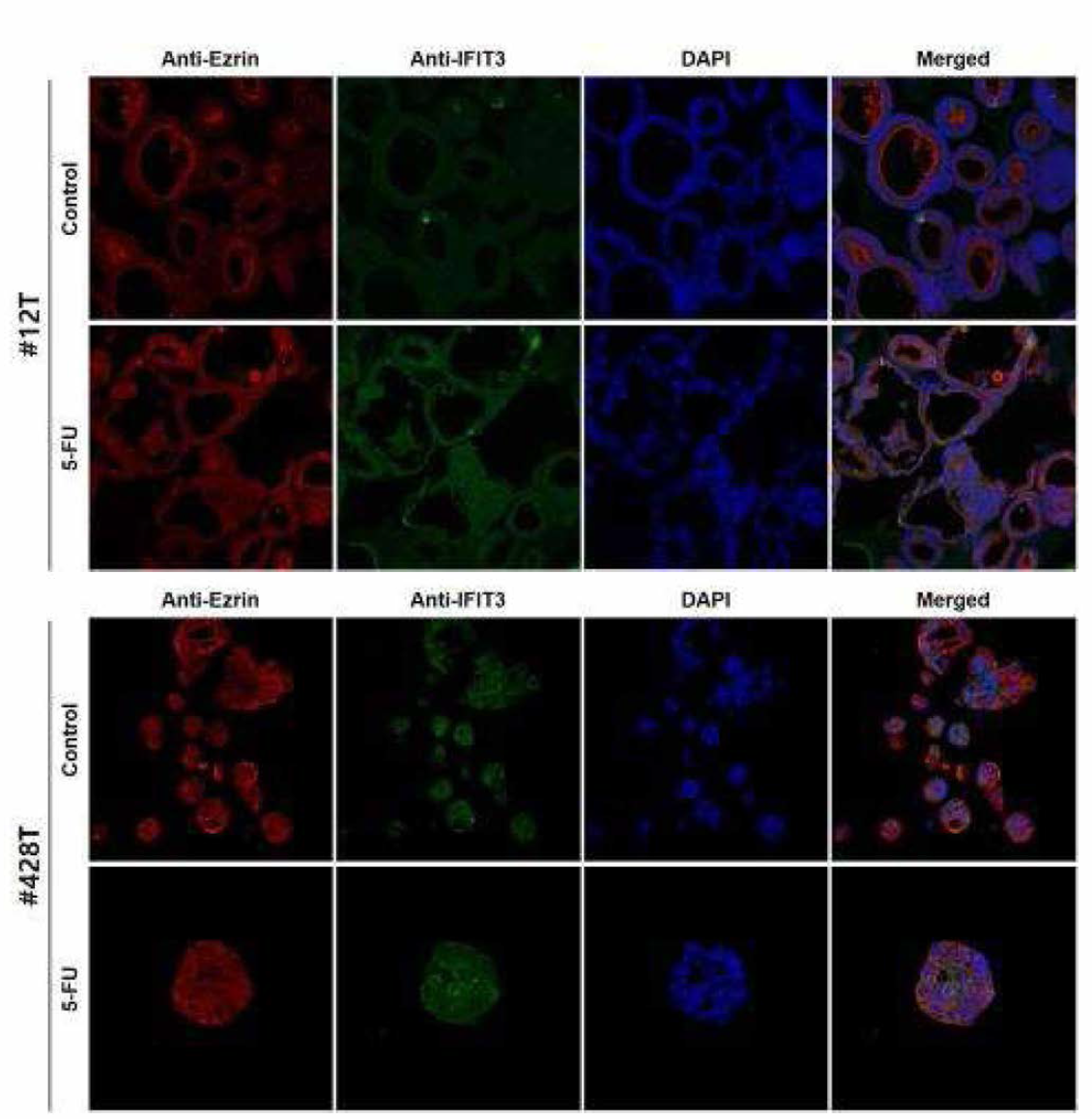 오가노이드 13종의 Anti-Ezrin과 Anti-IFIT3 이중형광염색 (연속)