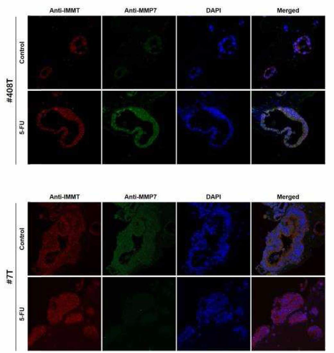 오가노이드 13종의 Anti-IMMT와 Anti_MMP7 이중형광염색