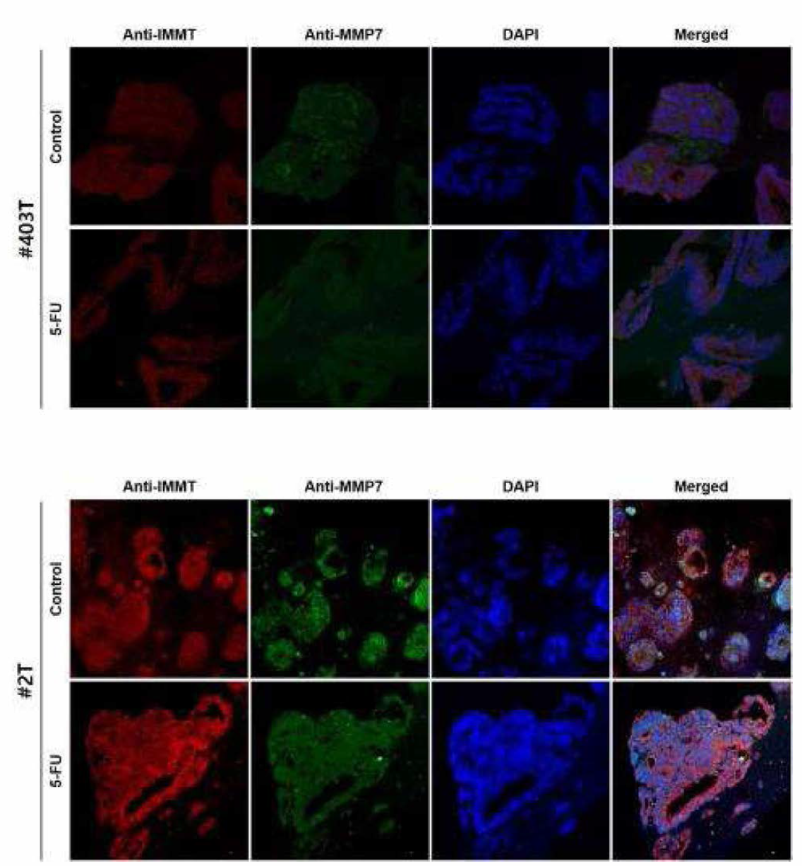 오가노이드 13종의 Anti-IMMT와 Anti_MMP7 이중형광염색 (연속)