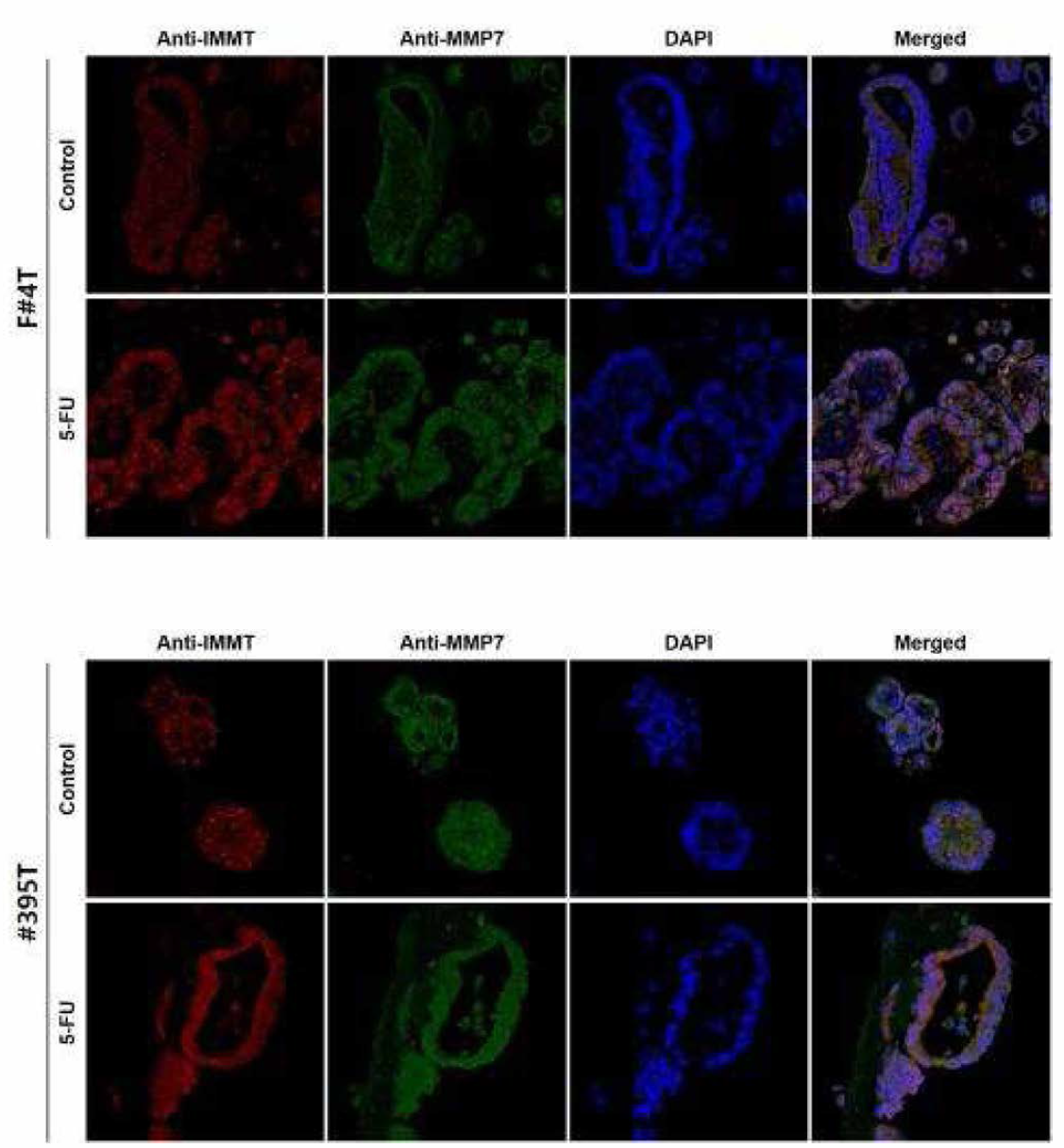 오가노이드 13종의 Anti-IMMT와 Anti_MMP7 이중형광염색 (연속)