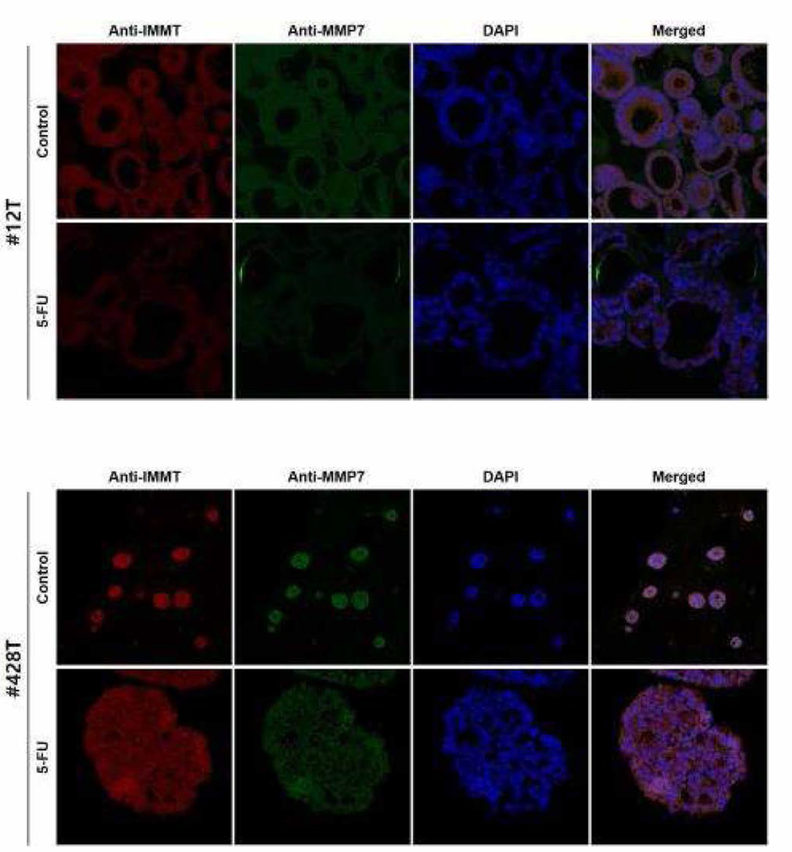 오가노이드 13종의 Anti-IMMT와 Anti_MMP7 이중형광염색 (연속)