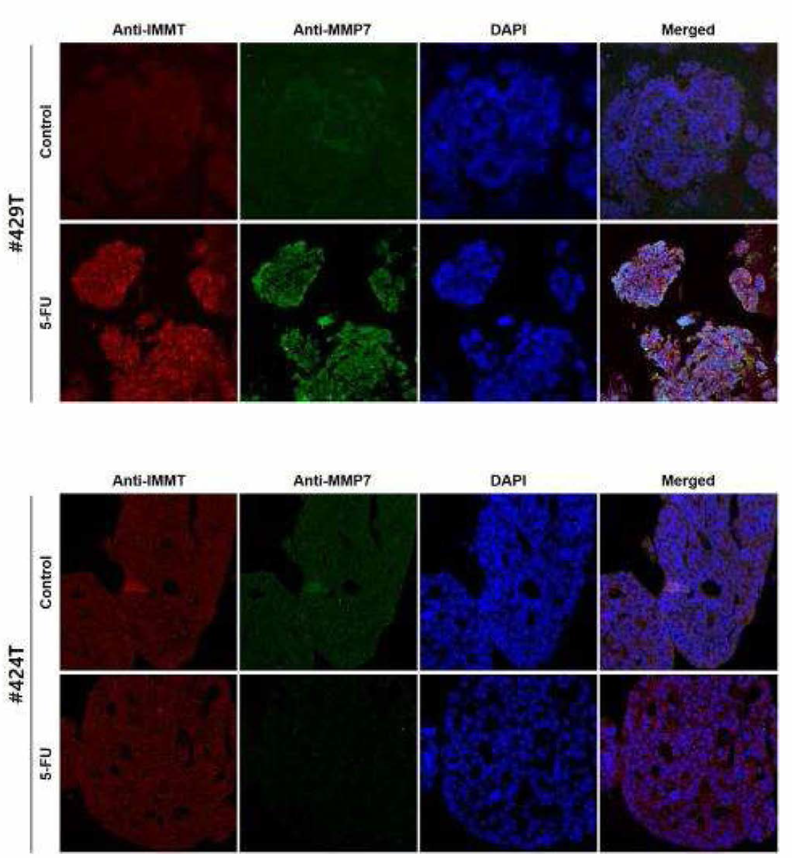 오가노이드 13종의 Anti-IMMT와 Anti_MMP7 이중형광염색 (연속)