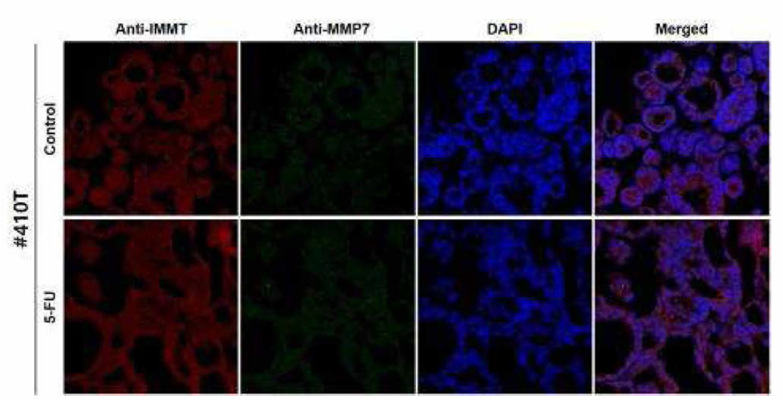 오가노이드 13종의 Anti-IMMT와 Anti_MMP7 이중형광염색 (연속)
