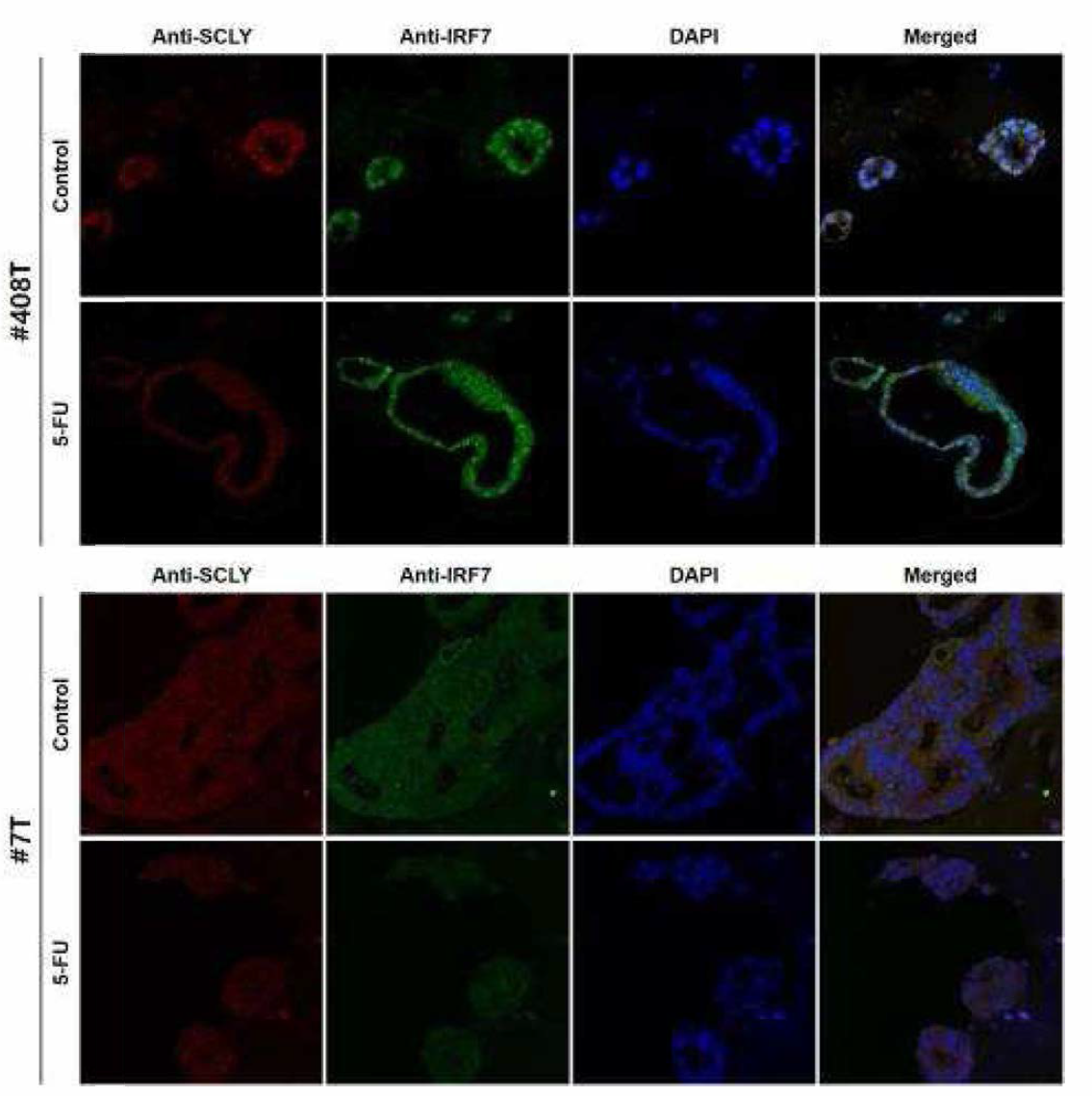 오가노이드 13종의 Anti-SCLY와 Anti_IRF7 이중형광염색