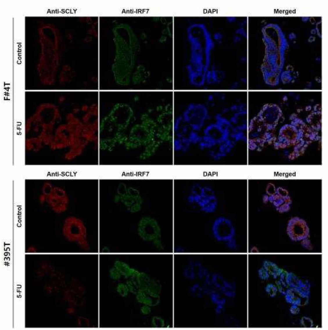 오가노이드 13종의 Anti-SCLY와 Anti_IRF7 이중형광염색 (연속)