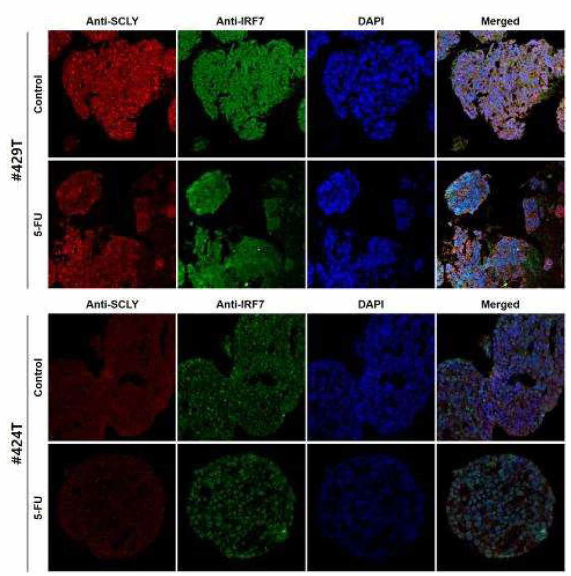 오가노이드 13종의 Anti-SCLY와 Anti_IRF7 이중형광염색 (연속)
