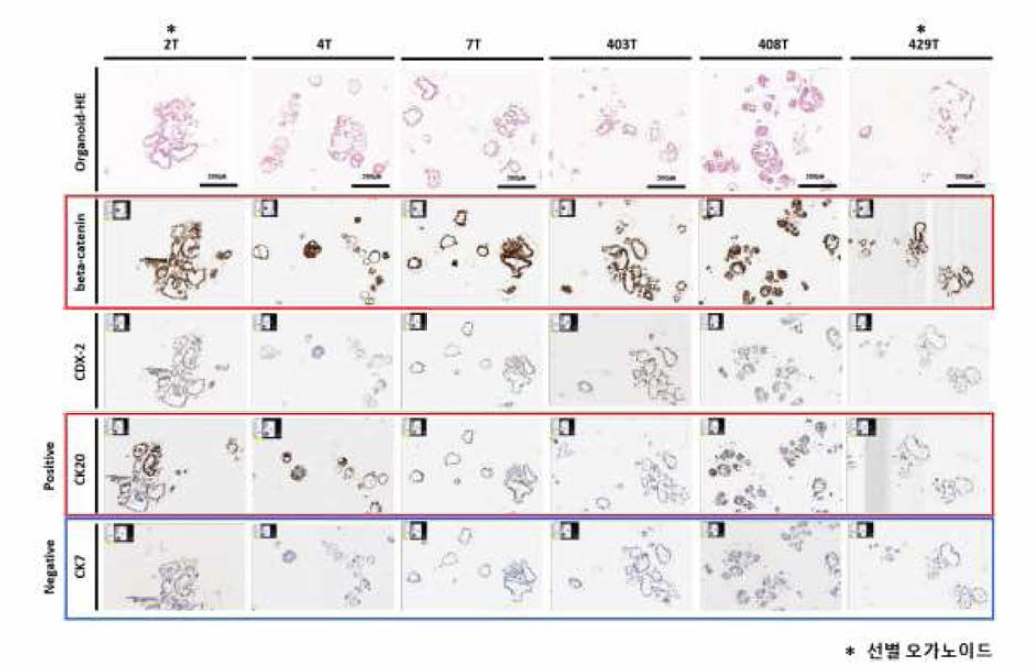 오가노이드 6종 면역화학염색 결과，대장암 특이적 분자 마커