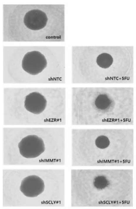 3차원적 유전자 발현억제 변형 세포주의 5-FU 에 대한 약물 반응