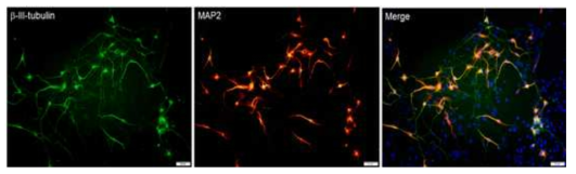 Sox1-GFP 세포에서 분화된 신경세포 확인