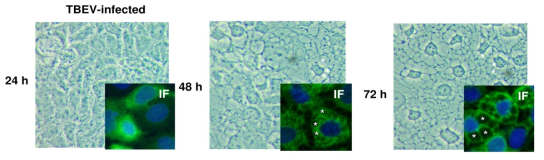 Caco-2 cell에 TBEV 감염 후 24h, 48h, 72h의 세포 형태의 변화(Yu, Chao 등, 2014)