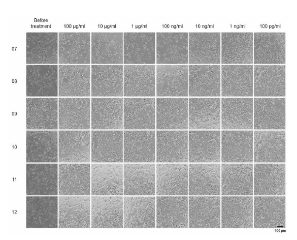 Antagonist pre-screen run, 시험 물질을 처리한 세포 사진 2