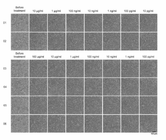 Antagonist pre-screen run, 시험 물질을 처리한 세포 사진 3