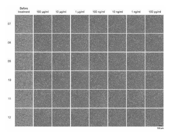 Antagonist pre-screen run, 시험 물질을 처리한 세포 사진 4