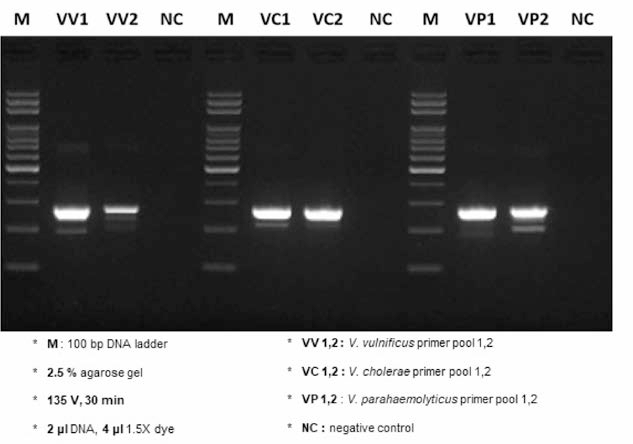 PCR 결과 확인