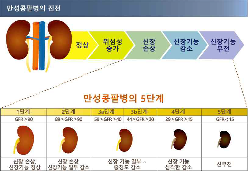 만성 콩팥병의 5단계