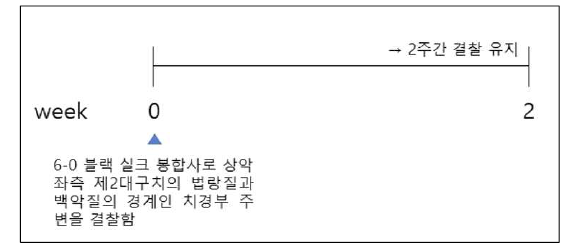 치주질환 유발 동물모델의 예 출처: 한국식품영양과학회지 2021, 50(7):672-678.