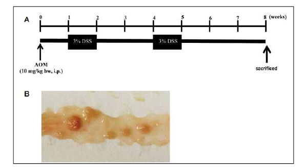 염증성 장질환 동물모델의 예 출처: Sci Rep 2019, 12;9(1):16636; Exp Ther Med 2017, 14(6):6069-6073