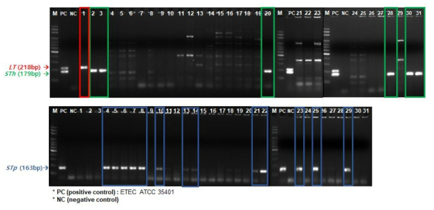 ETEC의 LT, STh, STp 유전자 확인 결과