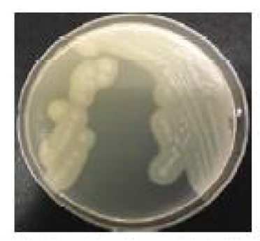 난황 첨가 TSC 한천배지에서의 Clostridium perfringens 군락