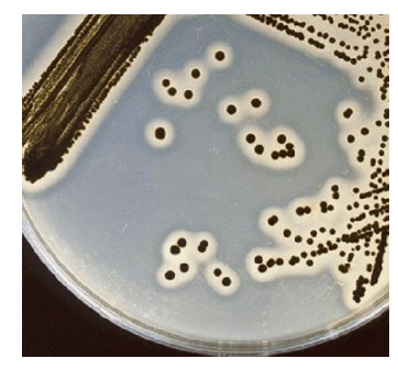 Egg Yolk for MSA에서의 Staphylococcus aureus 군락