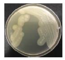 난황 첨가 TSC 한천배지에서의 Clostridium perfringens 군락