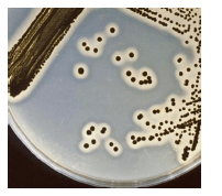 Egg Yolk for MSA에서의 Staphylococcus aureus 군락