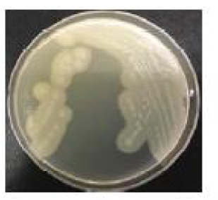 난황 첨가 TSC 한천배지에서의 Clostridium perfringens 군락