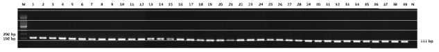 18S rRNA를 활용한 DNA 유무 확인 결과(Conventional PCR)