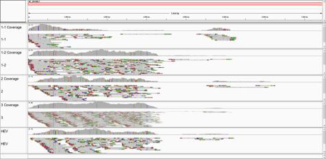 Nanopore sequencing reads mapped to reference genome without trimming