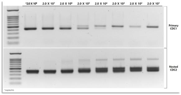 A형 간염바이러스 capsid region PCR 고도화 PCR band