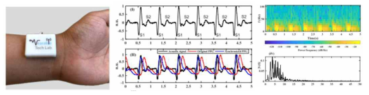 헬스케어 모니터링 시스템을 위한 손목 부착형 음향 센서 모듈 연구